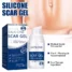 Scar-Removal-Gel-in-Pakistan