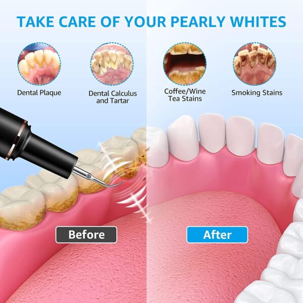 81aXRGwuEML._SL1500_ Dental tartar remover replacement tips and accessories Pakistan