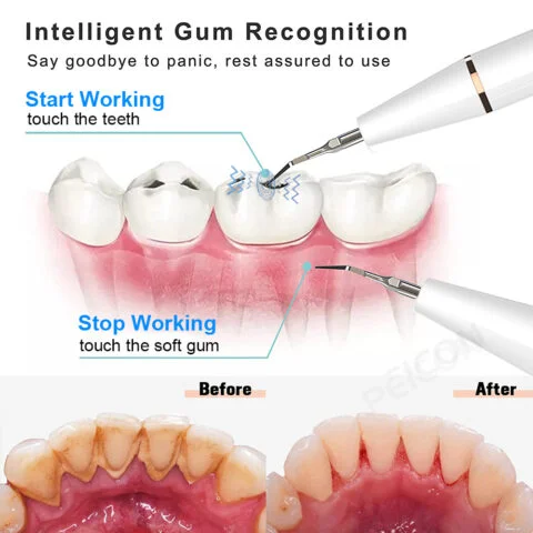 UltrasonicDentalTartarRemoverElectricUltraSonic1 Dental tartar remover replacement tips and accessories Pakistan